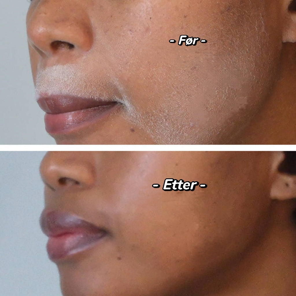 Nyskaping
Håridentifikasjonsspray Dermaplanner