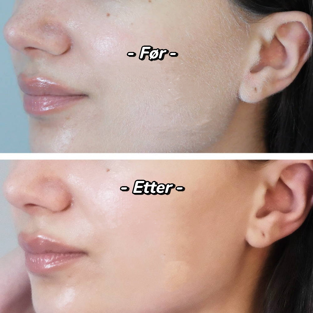 Nyskaping
Håridentifikasjonsspray Dermaplanner